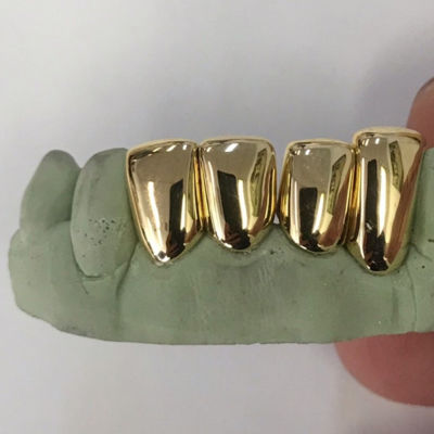 Can You Sell Your Gold Teeth?